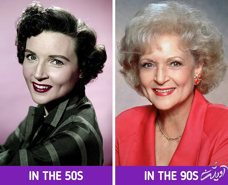 ۱۱ حقیقتی که ثابت می کند عمل های زیبایی از گذشته وجود داشتند